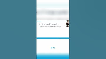 Segment Data For Metrics Signal to Noise Ratio