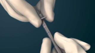 Using BondBone 1cc for Socket Preservation-animation.wmv
