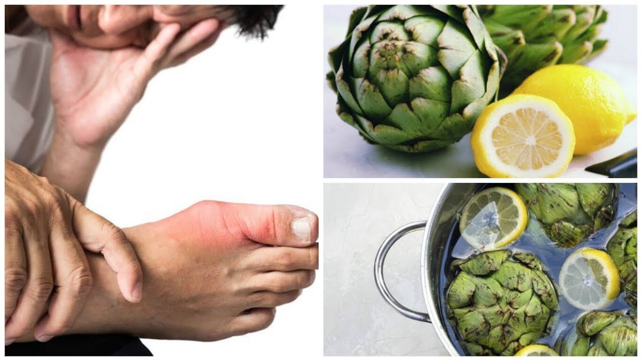 remedios naturales para la artritis Elimina el exceso de ácido úrico de tu cuerpo con agua de alcachofa y limón