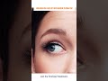 Neogen Plasma Facelift | Non-Surgical Skin Tightening Explained
