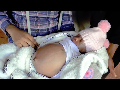 Video: Baby Mermaid Was Born In India - Alternative View