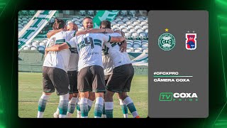 #CFCxPRC - Câmera Coxa