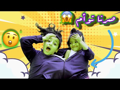 تحدي التوام الملتصق ليوم كامل ! شفا