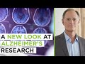 Why enhancing metabolic health could be the key to preventing alzheimers disease