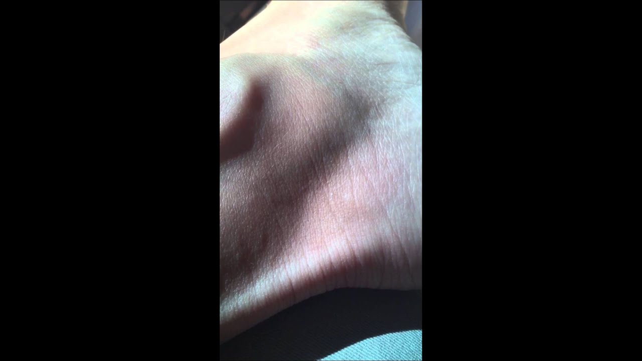 My bounding posterior tibial pulse - YouTube