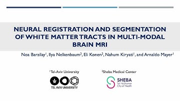Neural Registration and Segmentation of White Matter Tracts in Multi-modal Brain MRI