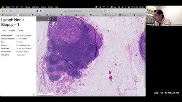 Top 10 Final Projects (Full Stack Deep Learning - Spring 2021)