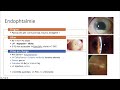 Urgences ophtalmologique  rougeur ou douleur oculaire non traumatique avec bav