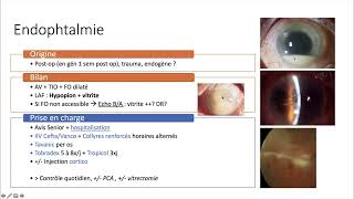 Urgences ophtalmologique - rougeur ou douleur oculaire non traumatique avec BAV