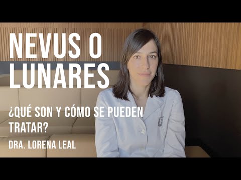 Video: ¿Qué causa un nevus?