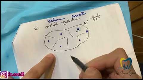 Tips and tricks about Class II composite restorations (Hands on).