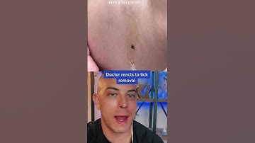 Doctor reacts to odd tick removal! #tick #dermreacts #oliveoil
