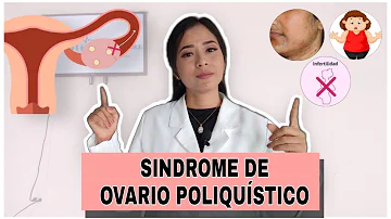 ¿El síndrome de ovario poliquístico produce vello en la barbilla?