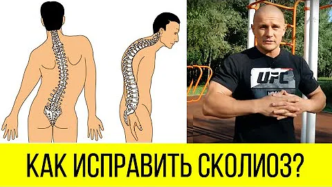 Как исправить сколиоз. [Комплекс упражнений]. Михаил Яцык