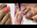 Most ugly toenails Transformation 😱best nail polish for toes 2020 pedicure transformation #33