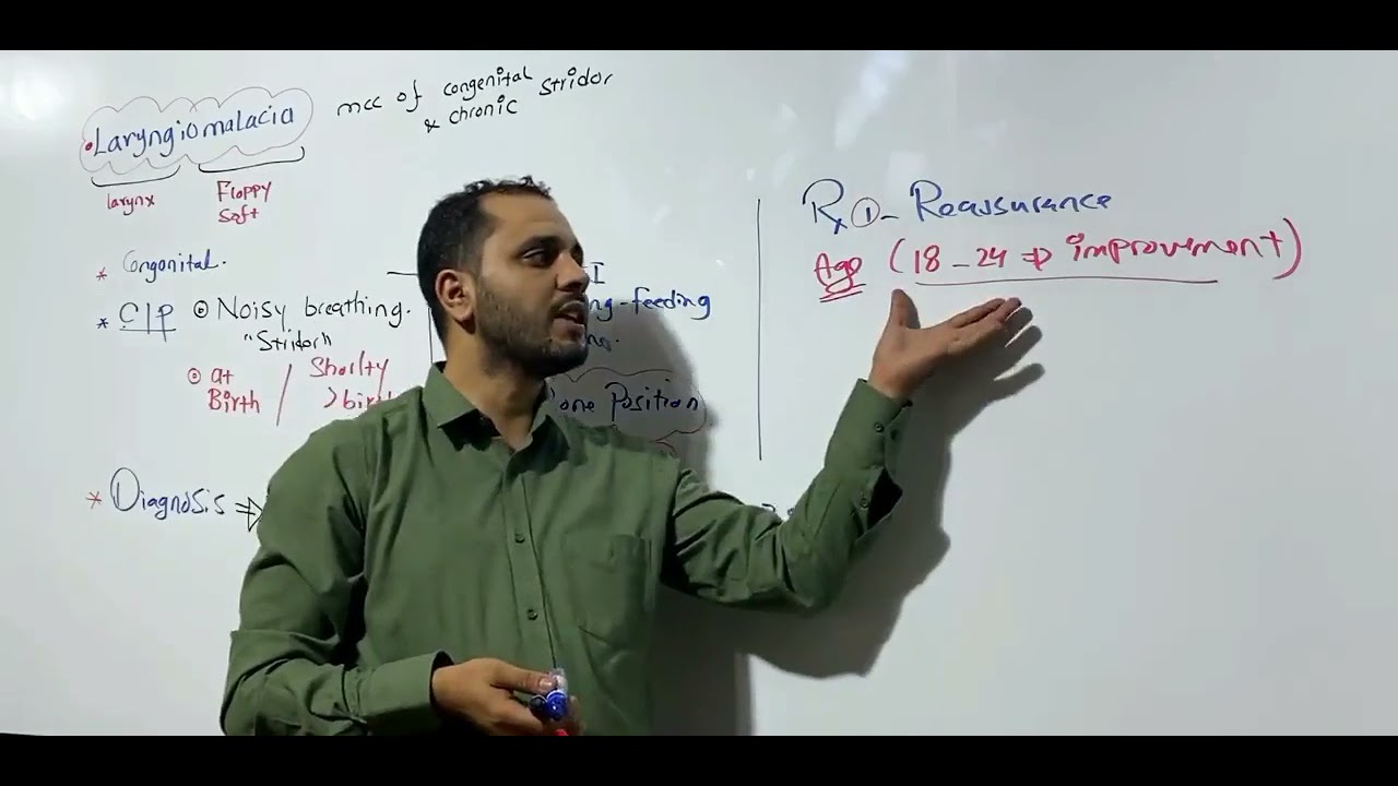 laryngiomalacia