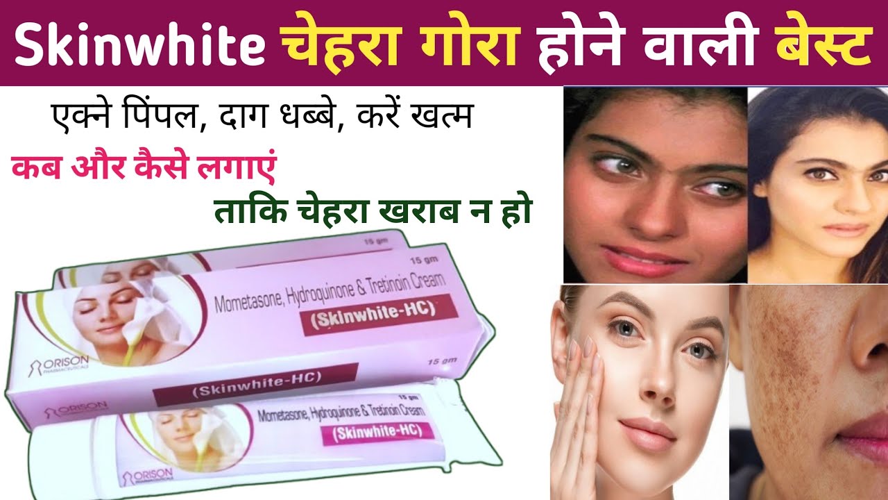 Skinwhite hc cream | skinwhite whitening cream | skin white cream | skinshine cream | fairness cream