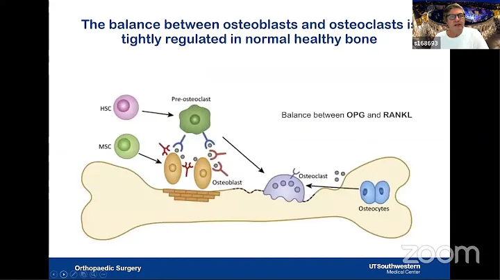 Diagnosis and Treatment of Charcot NeuroArthropathy
