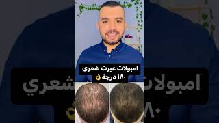 امبولات غيرت شعري ١٨٠ درجة 👌