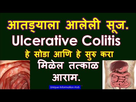 आतड्याला आलेली सूज. Ulcerative Colitis हे सोडा आणि हे सुरु करा, मिळेल तत्काळ  आराम.