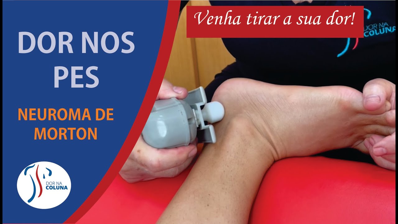 DOR NOS PÉS - Neuroma de Morton