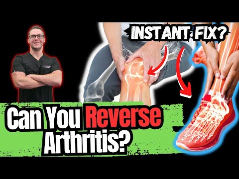 Video: Bilakah sakit arthritis lebih teruk?