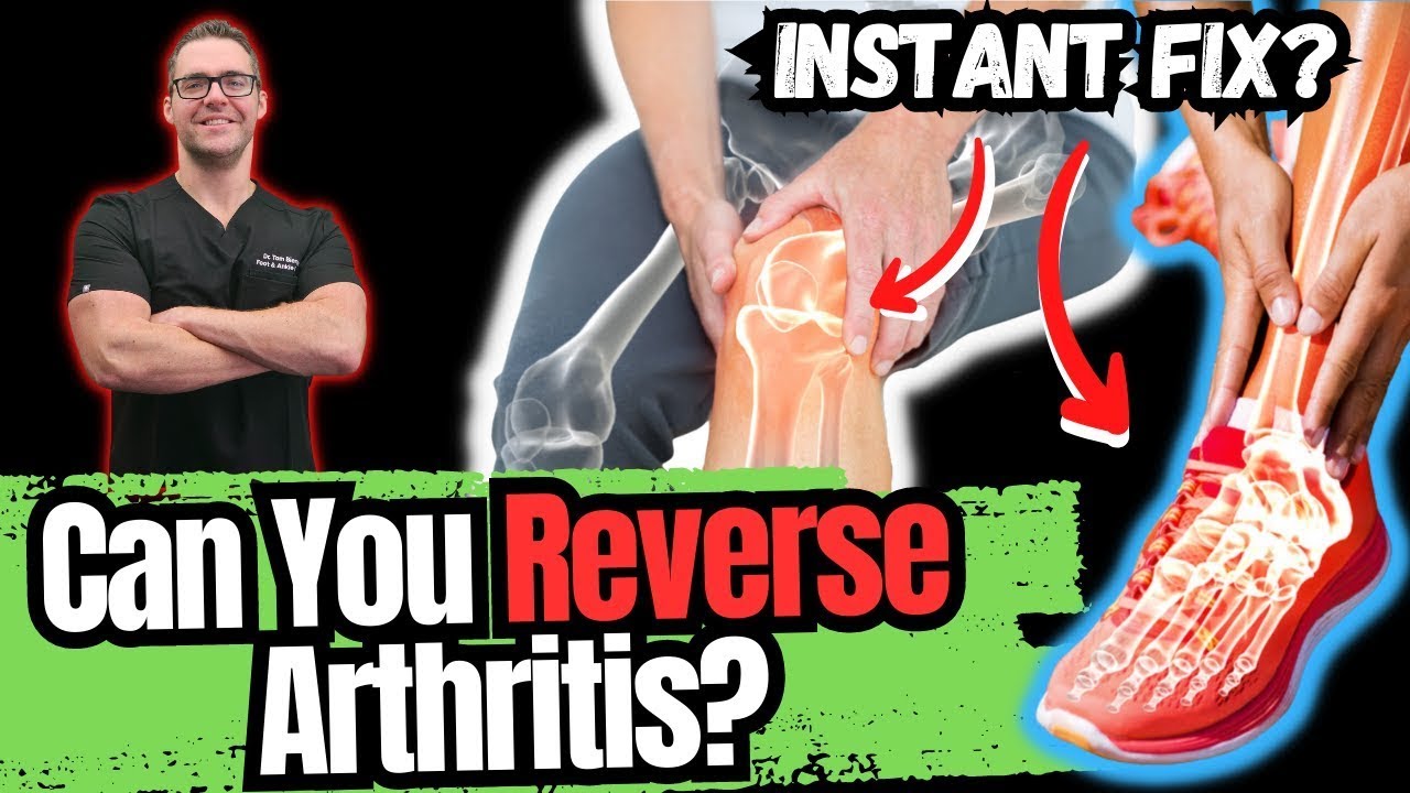 BEST 5 Ways to STOP Arthritis Pain [Big 2023 New SECRETS!]