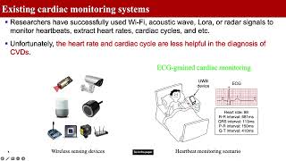 ECG-grained Cardiac Monitoring Using UWB Signals