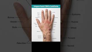 Different types of skin lesions with their apperance .