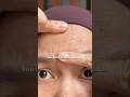 Who needs botox at 30 when your eye cream works this good? #numbuzin #retinal #nad