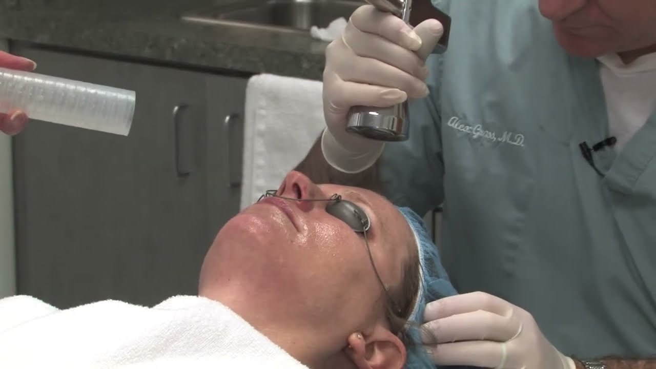 Drastically Improve Your Skin's Appearance with Micro Laser Peel & Profractional