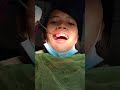 4 Premolar  extraction for braces