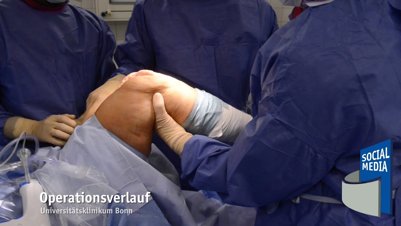 Was passiert vor, whrend und nach einem Kniegelenkersatz?