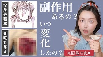 花咲乳がん Youtube