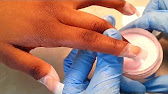 ACRYLIC NAIL POPPITS- How to - YouTube