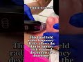 Morpheus8 Toronto - Morpheus8 Near Me - Book a FREE Consultation (416) 969-9669!
