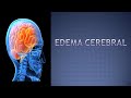 Neurocirujano | ¿ Qué es un edema Cerebral | síntomas y tratamiento 🧠