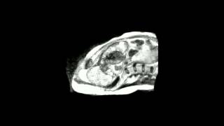 Birth in an MRI