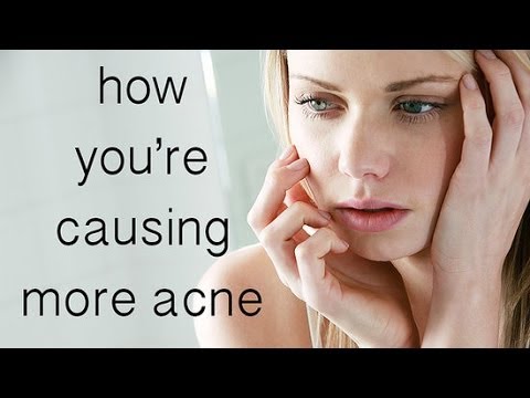 How to Beat the Bad Habit That&#;s Causing Acne | Beauty How To