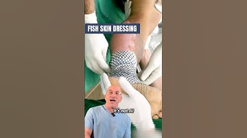 Fish Skin Band-Aid For Faster Burn Wound Healing 🔥 #shorts