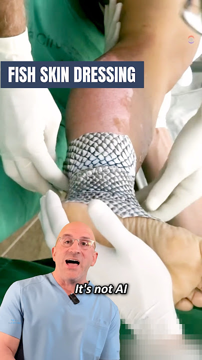 Fish Skin Band-Aid For Faster Burn Wound Healing 🔥 #shorts