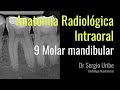 Anatomía radiográfica intraoral clase ODON210 9