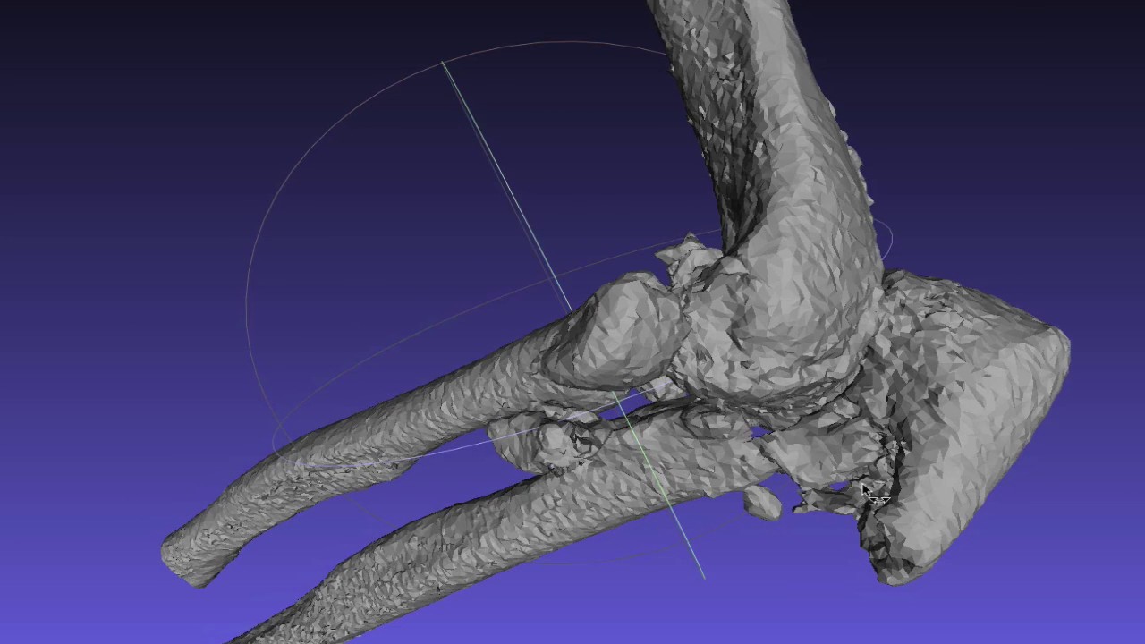 Elbow - Distal ulna and Radius - YouTube