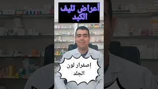 أعراض تليف الكبد