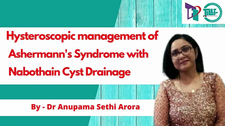 Hysteroscopic Management of Ashermann's Syndrome w...