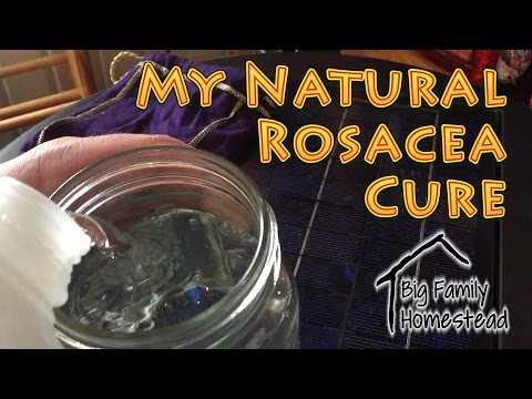 Video: Sådan behandles rosacea: Kan naturlægemidler hjælpe?
