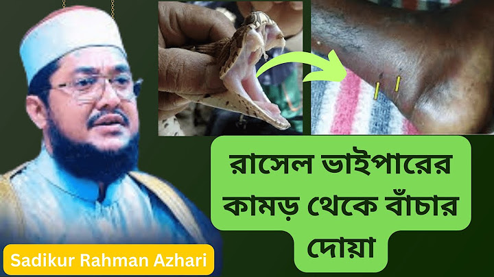 রাসেল ভাইপারের কামড় থেকে বাঁচার দোয়া | রাসেল ভাইপার | Sadikur Rahman Azhari | Bangla Waz
