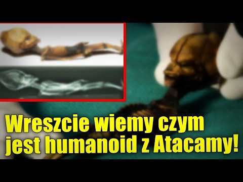 Wideo: Naukowcy Opublikowali Wyniki Badań Nad Miniaturową Mumią „obcych” Z Pustyni Atakama - Alternatywny Widok