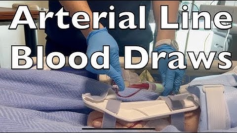 Drawing Blood from an Arterial Line