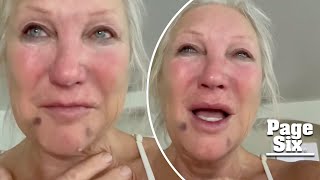 ‘Liar’ Hulk Hogan slammed by ex-wife Linda as she sobs over estrangement from daughter Brooke